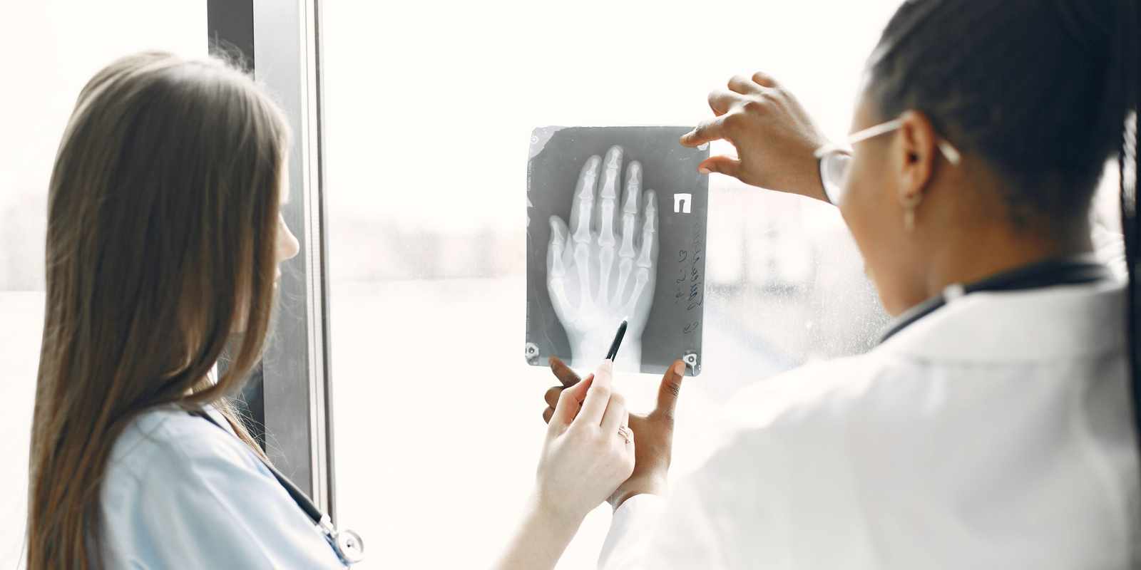 Two doctors standing by a bright window, one holding up an X-ray of a hand while the other points at it